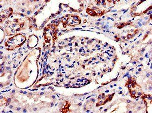 AQP6 Antibody