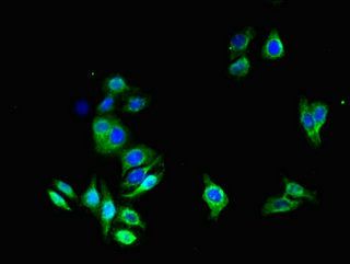 Aquaporin 1 antibody