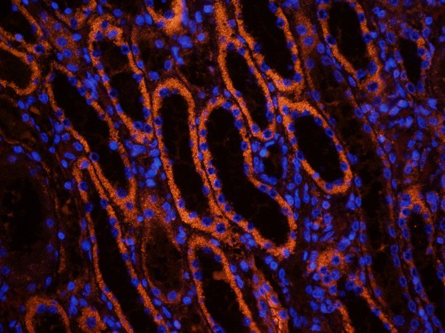 Aquaporin 2 antibody