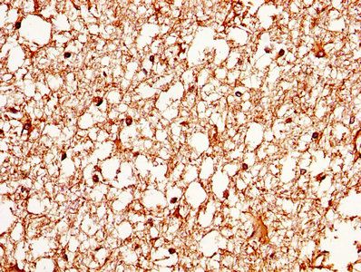 AQP4 Antibody