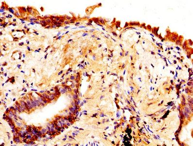 AQP4 Antibody
