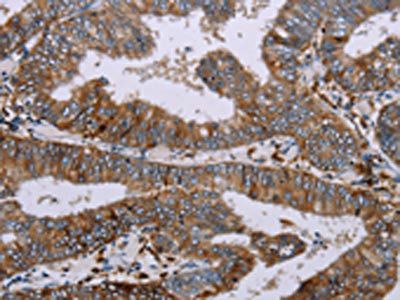 AQP4 Antibody