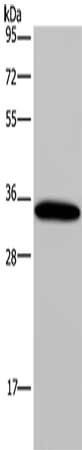 Aquaporin 4 antibody