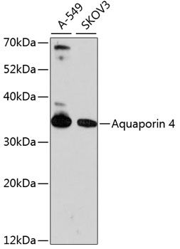 Aquaporin 4 antibody