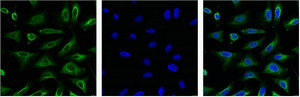 AQP4 Monoclonal Antibody
