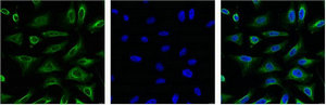 Aquaporin 4 antibody