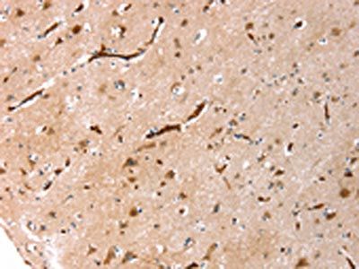 AQP1 Antibody