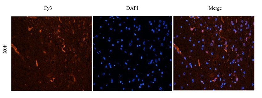 Aquaporin 1 antibody