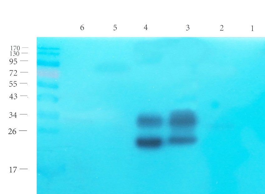 Aquaporin 1 antibody