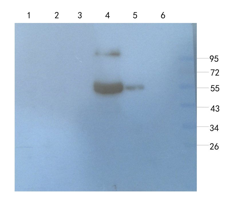 Aquaporin 4 antibody