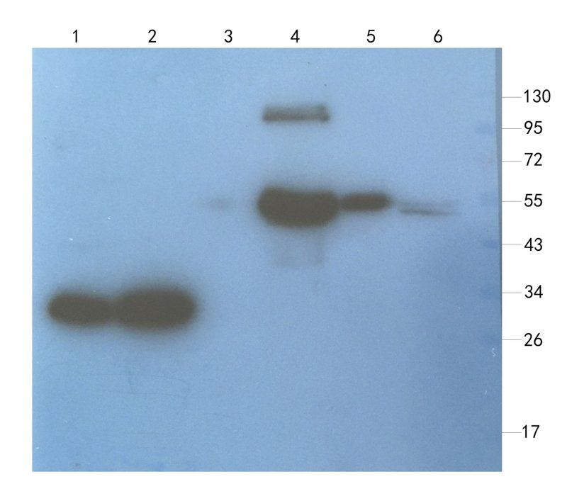 Aquaporin 4 antibody