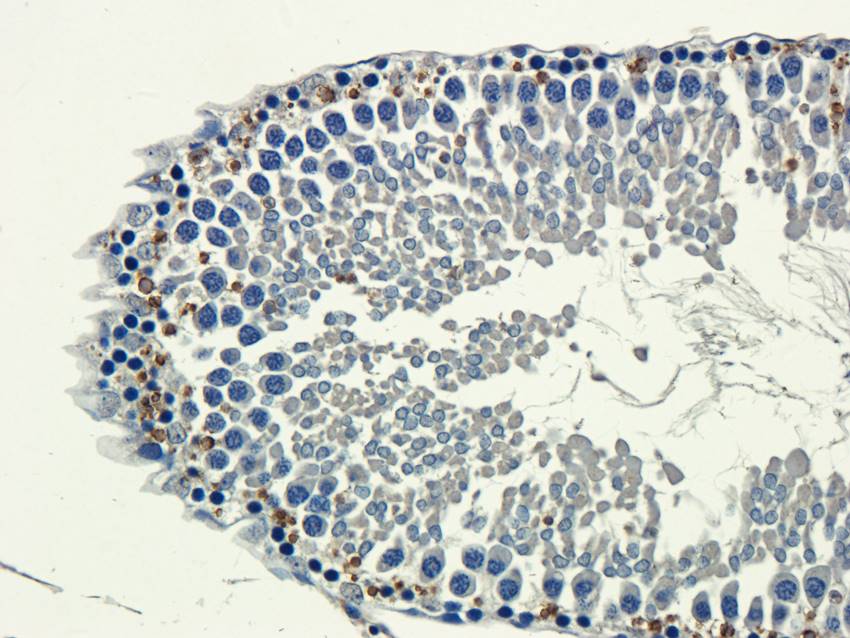 Aquaporin 9 antibody