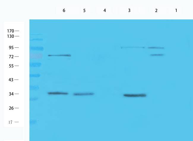 Aquaporin 9 antibody