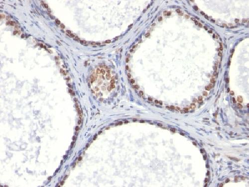 AR Antibody