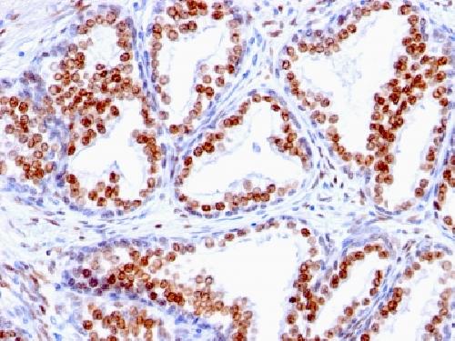 AR Antibody