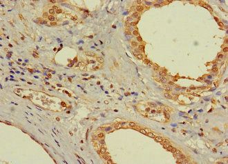 AR Antibody