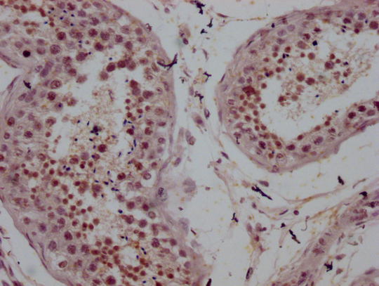 AR Antibody