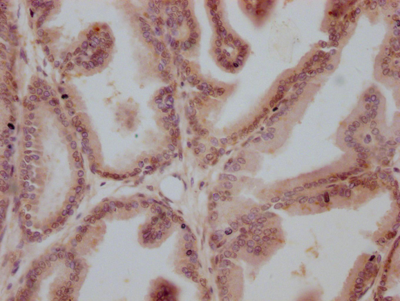 AR Antibody