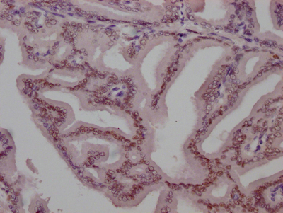 AR Antibody
