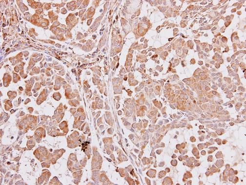 ARA9 Rabbit Polyclonal Antibody