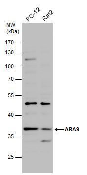ARA9 Rabbit Polyclonal Antibody