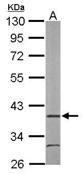 ARA9 Rabbit Polyclonal Antibody