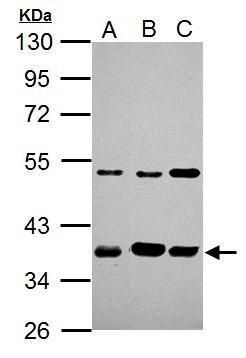 ARA9 Rabbit Polyclonal Antibody