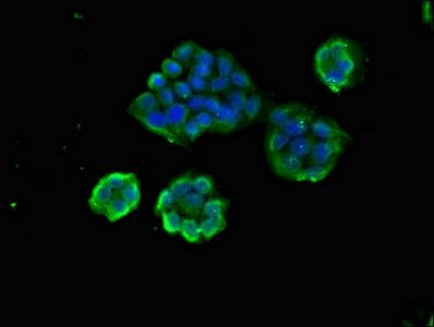 ARAP1 Antibody