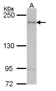 AGAP1 antibody [C3], C-term