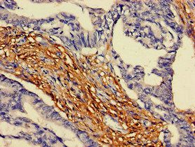 ARAP3 Antibody