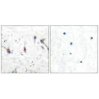 ARC antibody