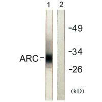 ARC antibody