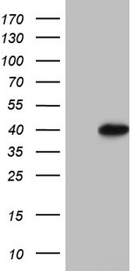 ZEB1 Antibody