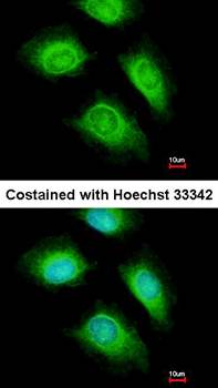 ARF1 antibody