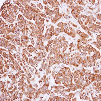 ARF1 antibody