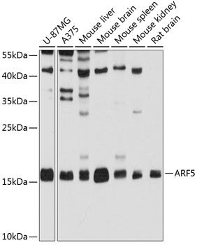 ARF5 antibody