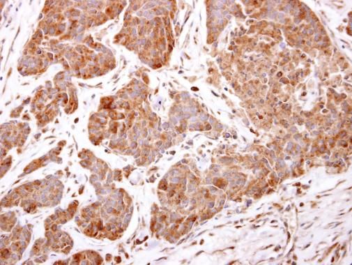 ARF5 antibody