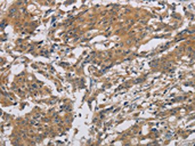 ARF6 Antibody