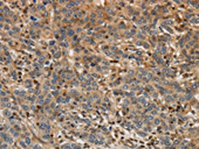 ARF6 Antibody