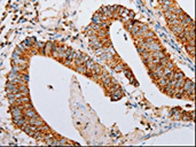 ARF6 Antibody