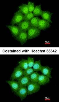 ARF7 antibody