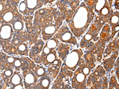 ARFGAP2 Antibody
