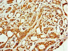 ARFGAP3 Antibody