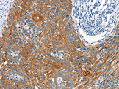 ARFGEF2 Antibody
