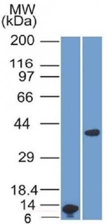 Arginase1 (Hepatocellular Carcinoma Marker) Antibody