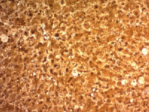 Arginase1 (Hepatocellular Carcinoma Marker) Antibody