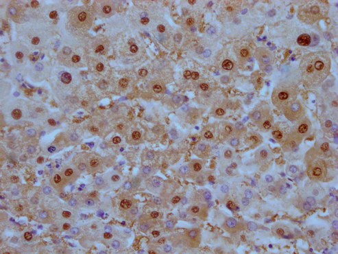 ARG1 Monoclonal Antibody