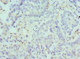 ARG2 Antibody