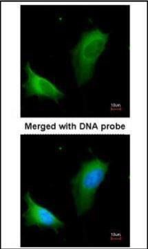 Arginase 1 antibody