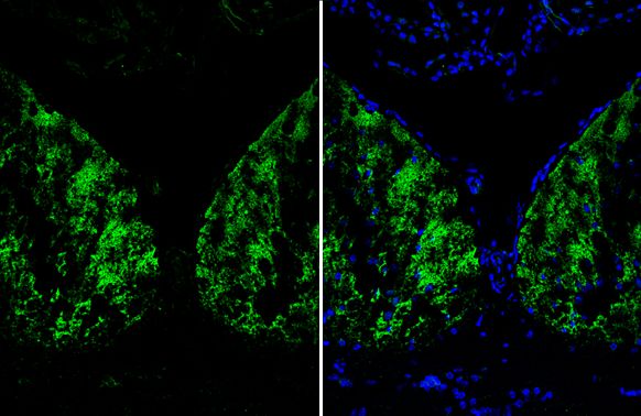 Arginase 1 antibody